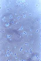 納豆菌バチルス